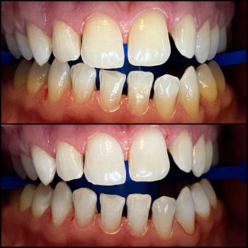 dental_hygienist_geneva