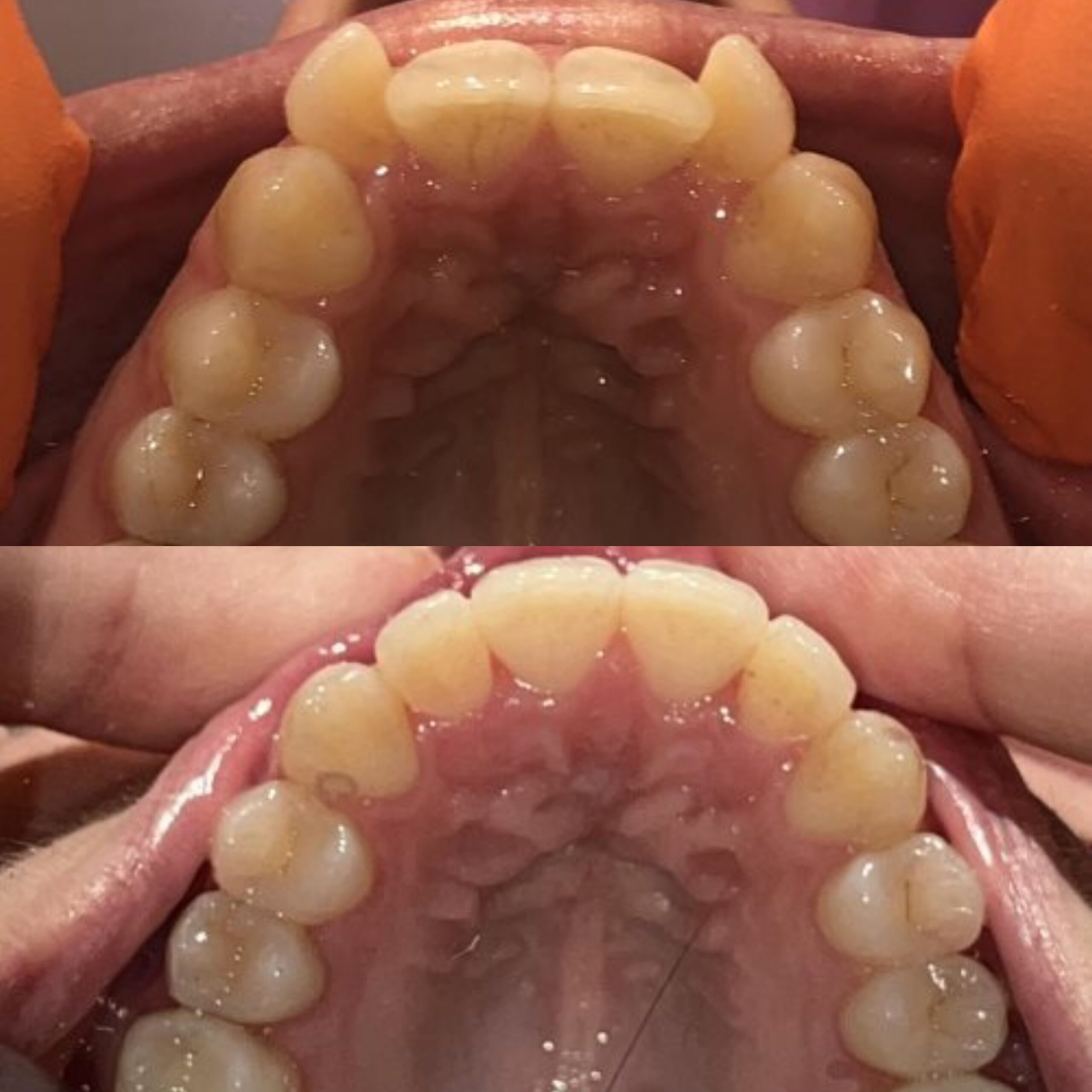 Invisalign Orthodontie Genève Lausanne