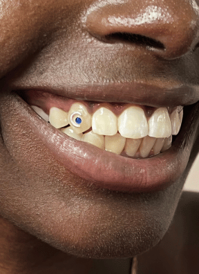 bijoux dentaire Genève