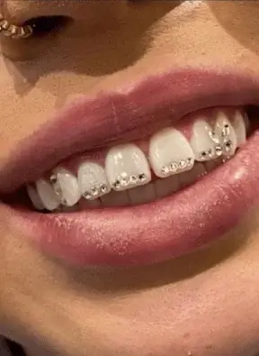 Teeth jewelry application