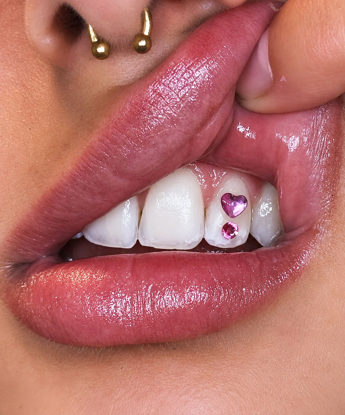 Strass dentaires roses chez Whitening Artists à Genève et Lausanne